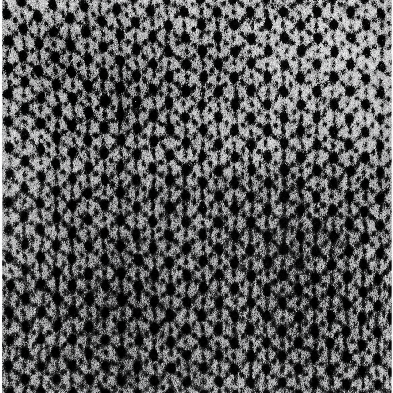 Electron micrograph of muscle fiber